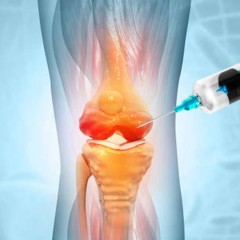 joint and nerve root injection